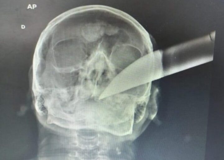 IMG-20210617-WA0082_copy_800x600-720x540-1-720x515