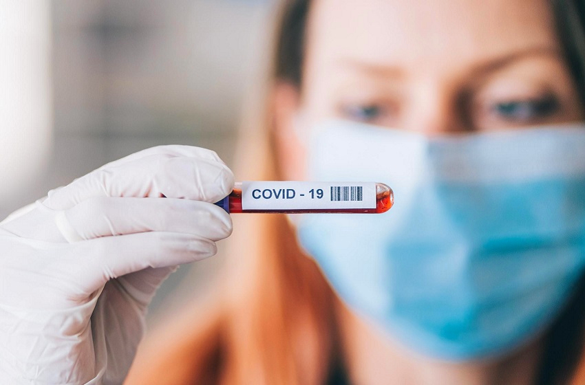 teste-covid-exame-coronavirus-1
