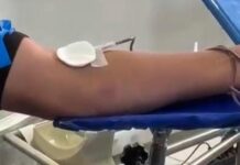 Timbé do Sul organiza nova viagem ao Hemosc para doação de sangue